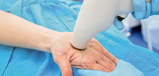 hypohidrosis treatment